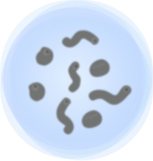 希瑪眼科中心_飛蚊症