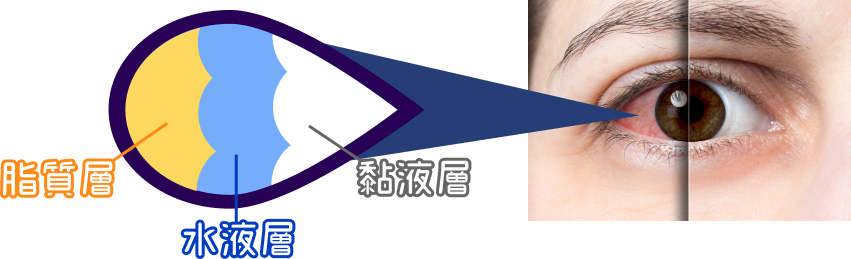 希瑪眼科中心_乾眼症成因