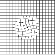 希瑪眼科中心_黃斑病變_眼睛檢查_阿姆斯勒方格表