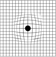 希瑪眼科中心_黃斑病變_眼睛檢查_阿姆斯勒方格表