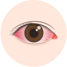 結膜炎(紅眼症)